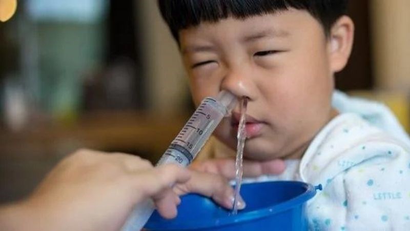Vệ sinh mũi họng sẽ giúp loại bỏ vi khuẩn và rút ngắn thời gian điều trị ho có đờm