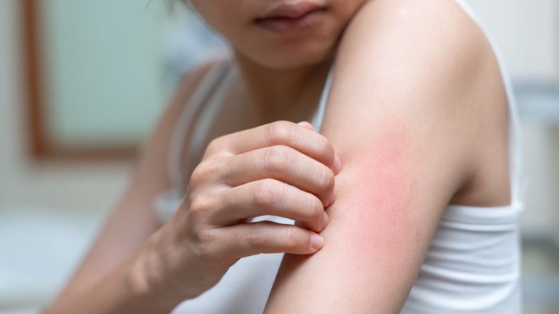 Tinh dầu xô thơm có nguy cơ gây dị ứng