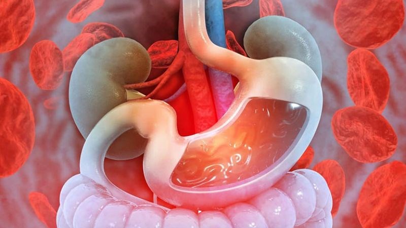 Dùng thuốc quá liều có thể gây xuất huyết dạ dày