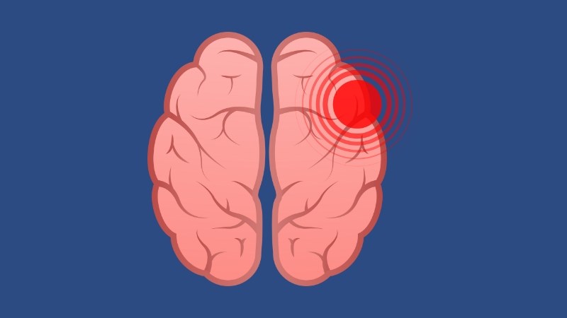 Hạt muồng trâu giúp chữa đau nửa đầu Hạt muồng trâu giúp chữa đau nửa đầu