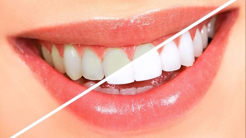 D-limonene trong vỏ quýt có thể mang lại tác dụng làm giảm vết ố trên răng