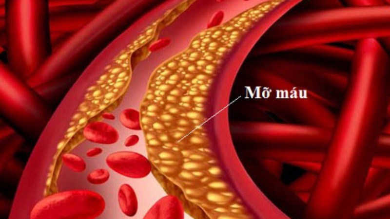 Cholesterol trong cơ thể giảm khi tiêu thụ nước ép lê
