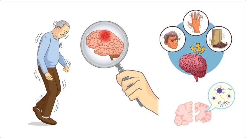 11/04 hàng năm là ngày Parkinson Thế giới với mục đích nâng cao nhận thức về căn bệnh này