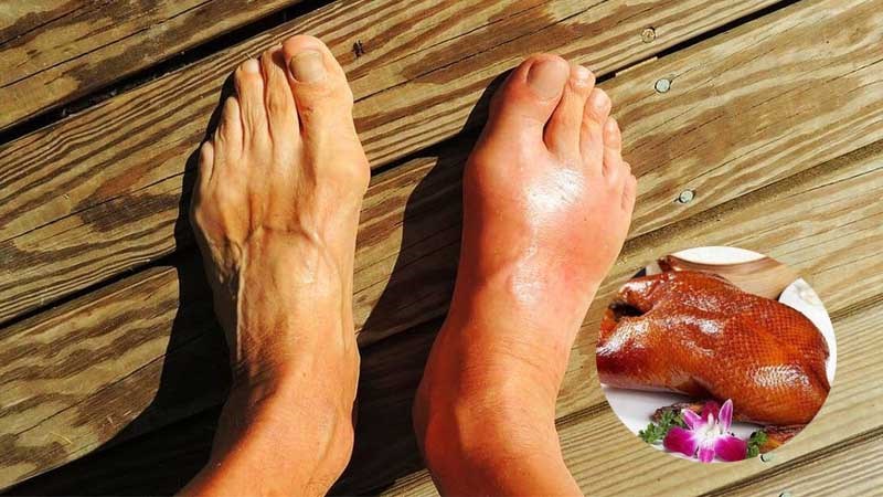 Những người bệnh gút chỉ được ăn thịt vịt với lượng vừa đủ và đúng cách Những người bệnh gút chỉ được ăn thịt vịt với lượng vừa đủ và đúng cách