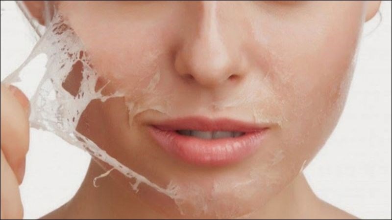 Tình trạng bong tróc da sau khi vi kim tảo biển thường xảy ra sau 3 -10 ngày