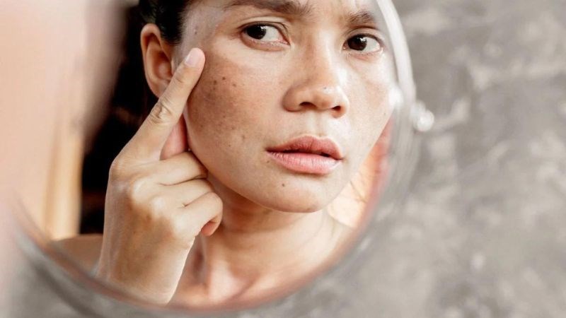 Những người gặp tình trạng như lão hóa da, rối loạn sắc tố da... nên sử dụng phương pháp vi kim tảo biển