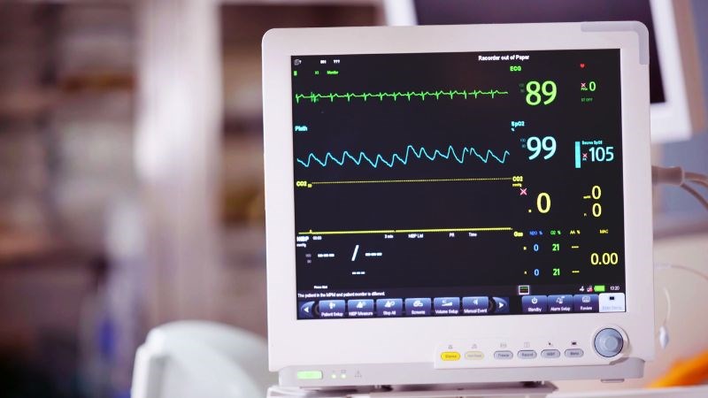 Điện tâm đồ là một trong các xét nghiệm cận lâm sàng giúp kiểm tra tim