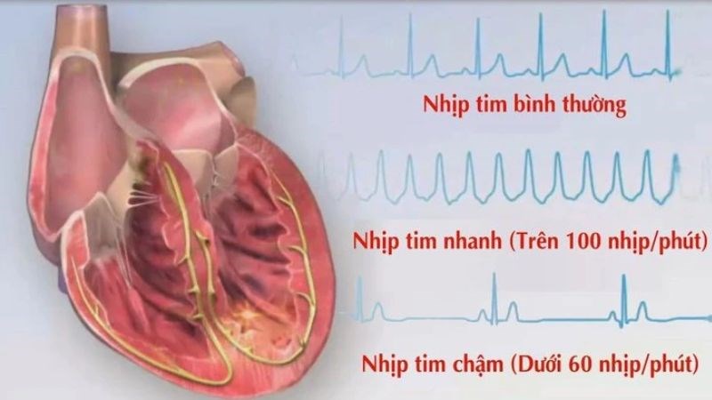 Khi có dấu hiệu tim đập nhanh hoặc chậm, bạn cần đến bác sĩ ngay để thăm khám