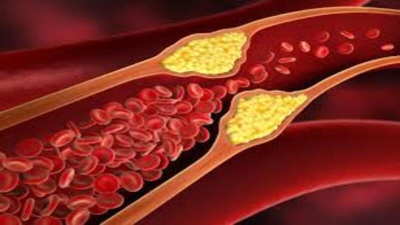 Các chất chống oxy hóa và hợp chất trong nấm Chaga đã được chứng minh có khả năng giảm cholesterol xấu, cholesterol toàn phần và triglyceride trong cơ thể
