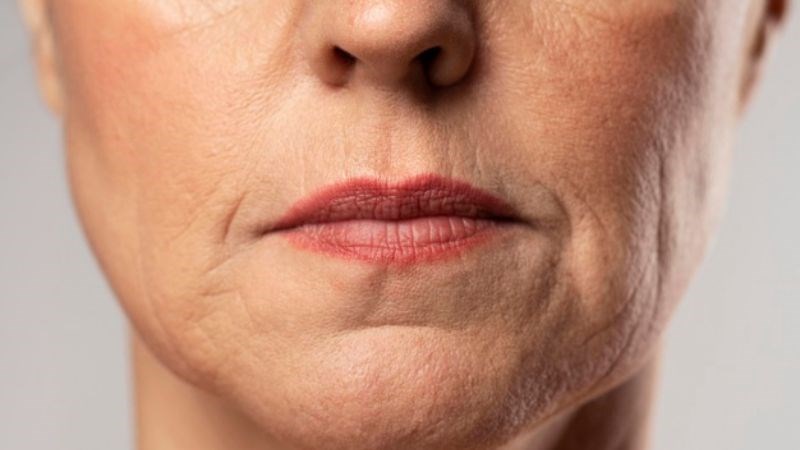 Cây vòi voi giúp chống oxy hóa và ngăn ngừa lão hóa hiệu quả