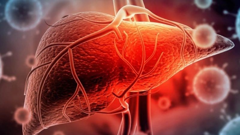 Uống nhiều rượu, bia trong thời gian dài gây quá tải cho gan và tổn thương chức năng gan