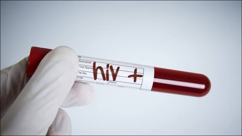 Test HIV được thực hiện để kiểm tra người bệnh có nhiễm HIV trước đây chưa