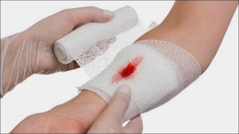 Hoạt chất trong rau sắng kích thích sản xuất collagen giúp chữa lành vết thương
