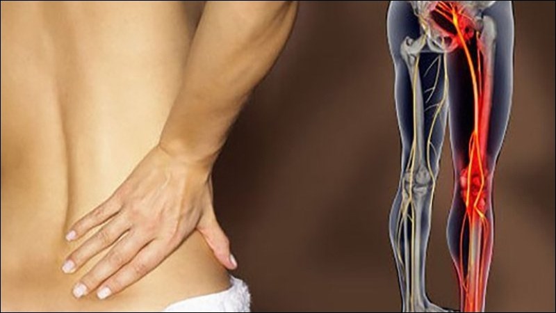 Rễ, thân chè dây giúp chữa đau dây thần kinh tọa