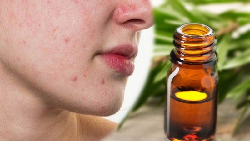 Tinh dầu trầm hương cũng l&agrave; một loại mỹ phẩm l&agrave;m đẹp da