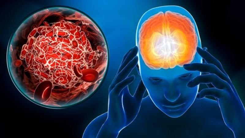Măng tây chứa hàm lượng folate hỗ trợ giảm thiểu nguy cơ đột quỵ