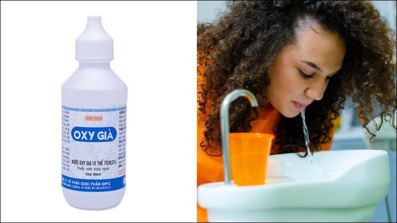 Súc miệng bằng nước oxy già giúp làm giảm đau và viêm răng