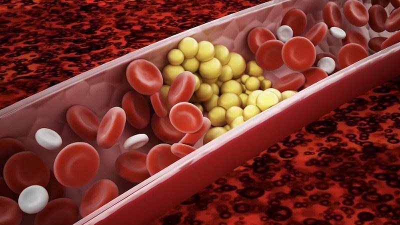 Polysaccharides nhựa đào giúp giảm nồng độ cholesterol xấu (LDL)