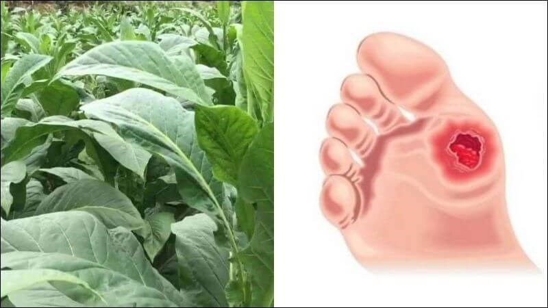 Đắp thuốc lào giã nát lên vết sâu giúp chữa sâu quảng