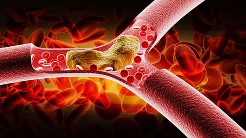 Các bài thuốc từ thảo quyết minh giúp giảm tình trạng mỡ máu cao