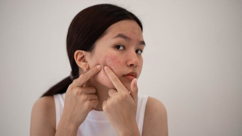 Tắm cho trẻ bằng bài thuốc từ hoàng đằng trị nổi mụn do nóng trong người