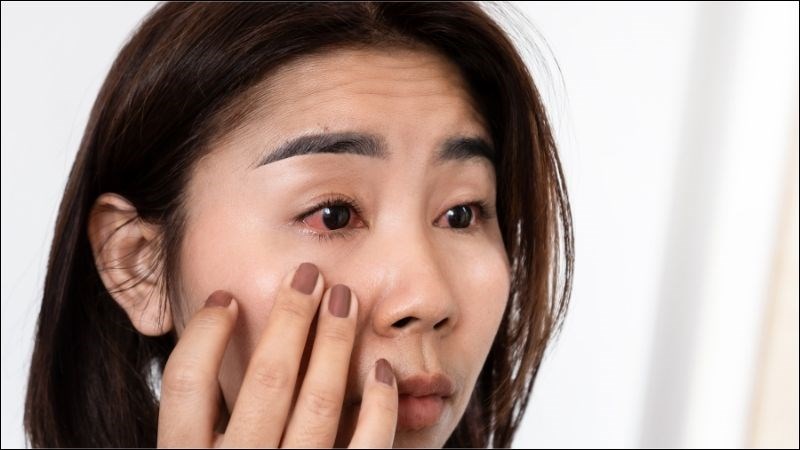 Kết hợp hoàng đằng với một số vị thuốc giúp chữa đau mắt sưng đỏ kèm chảy nước mắt