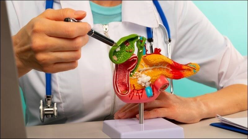 Những người mang nhóm máu B có nguy cơ mắc ung thư tuyến tụy ngoại tiết cao nhất