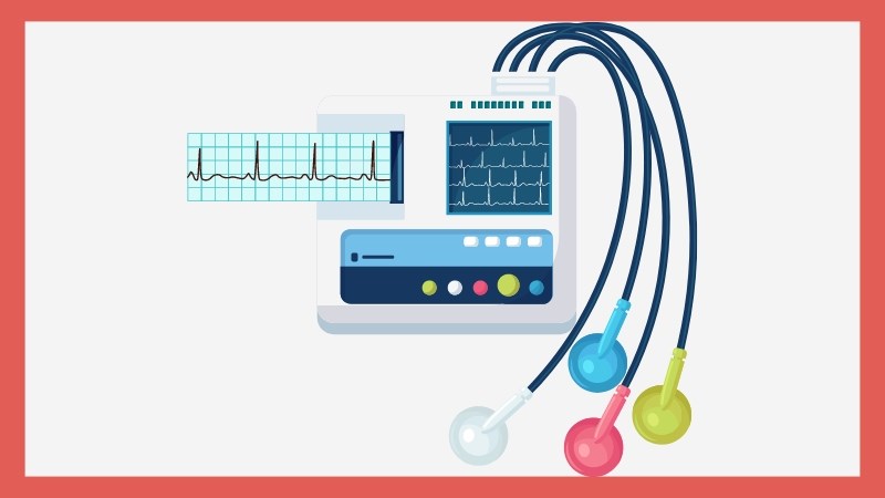 Điện tâm đồ (ECG) dùng để chẩn đoán rối loạn nhịp tim Điện tâm đồ (ECG) dùng để chẩn đoán rối loạn nhịp tim
