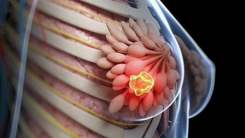 Vitamin E có tác dụng làm giảm xơ hóa vú ở phụ nữ
