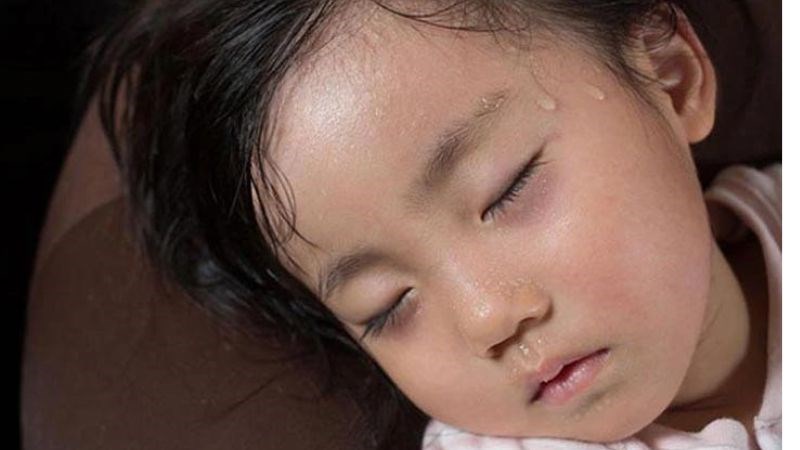 Trẻ mắc ung thư máu thường bị đổ mồ hôi nhiều, đặc biệt là vào ban đêm