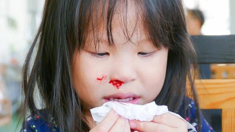 Chảy máu mũi thường xuyên có thể là biểu hiện ung thư máu ở trẻ em