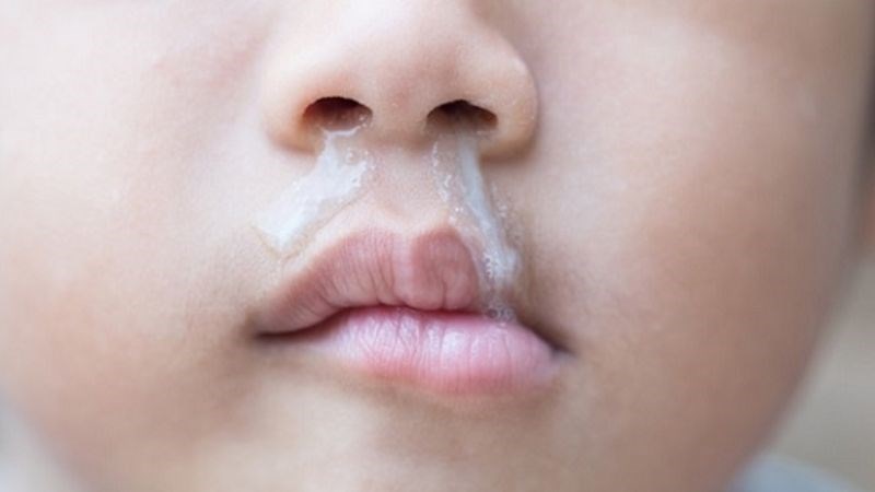 Biểu hiện nhiễm trùng do ung thư máu là chảy nước mũi không giảm dù dùng thuốc