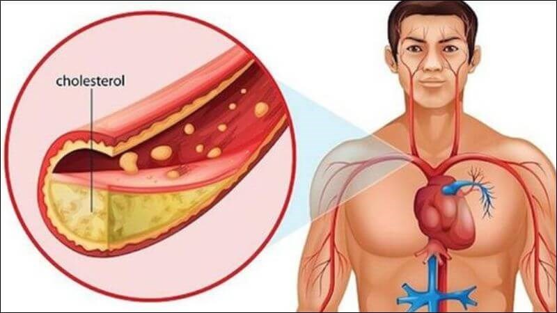 Chất chống oxy hóa trong đậu xanh có thể làm giảm cholesterol LDL và bảo vệ các hạt HDL-cholesterol (tốt) khỏi tác động của gốc tự do