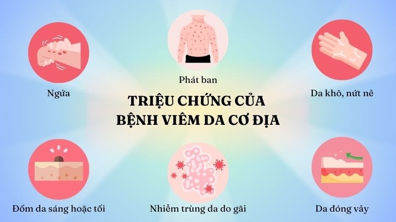Một số triệu chứng thường gặp của bệnh viêm da cơ địa