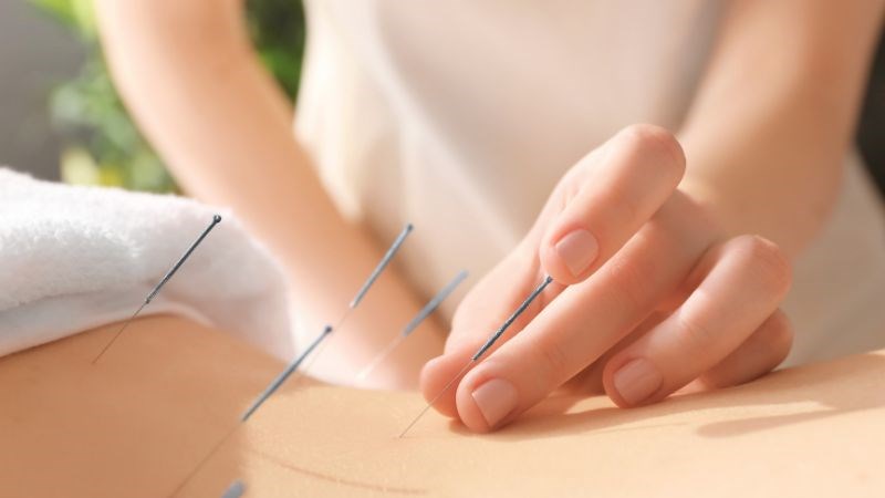 Châm cứu là phương pháp điều trị tình trạng bàng quang tăng hoạt và tiểu không tự chủ theo kinh nghiệm xưa