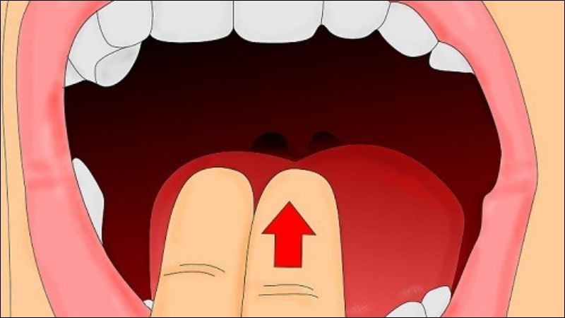 Gây nôn để loại bỏ chất độc khỏi cơ thể