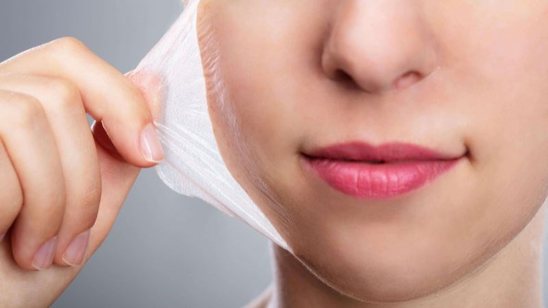 Da thường bị khô và kích ứng nhẹ sau khi peel da