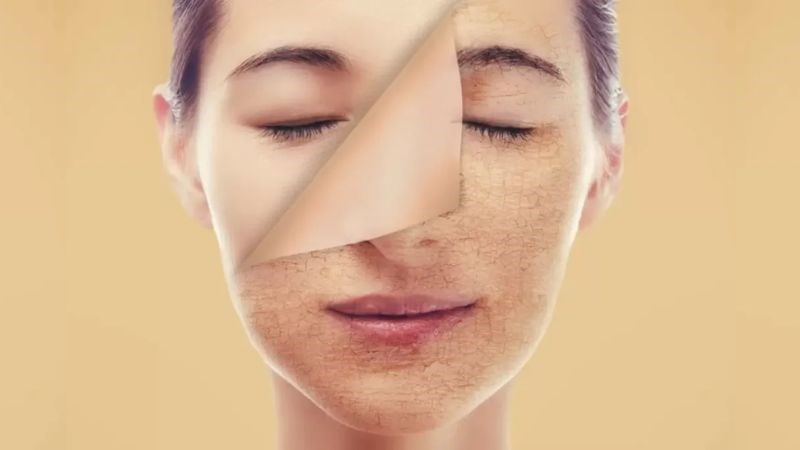 Peel da có thể làm da trở nên sẫm màu hoặc sáng màu hơn