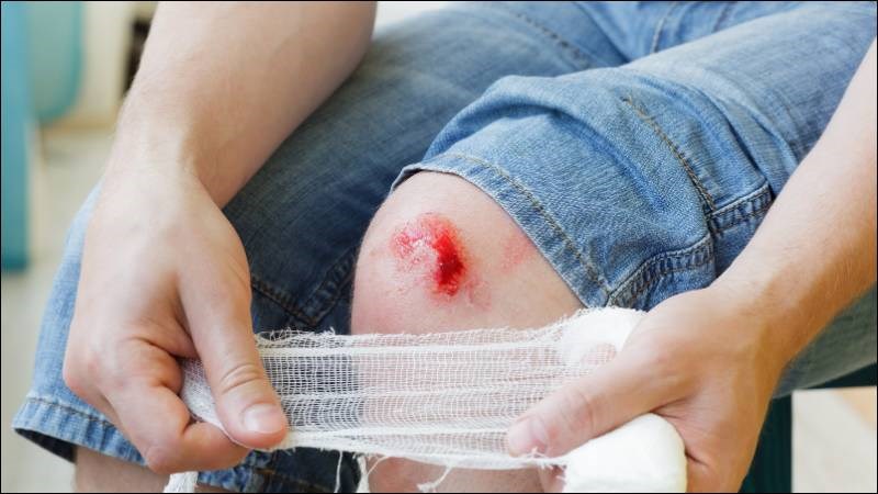 Các vết thương hở làm tăng nguy cơ nhiễm trùng da