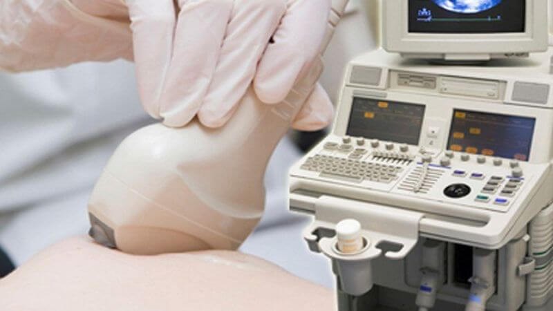 Siêu âm giúp chẩn đoán u nang vú Siêu âm giúp chẩn đoán u nang vú