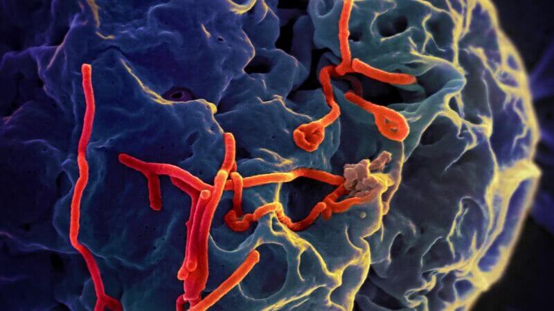 Dịch bệnh Ebola là dịch do virus Ebola gây nên