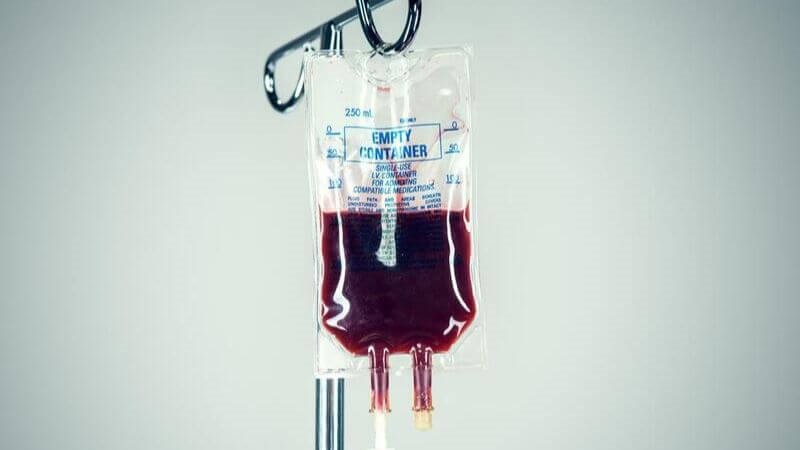 Gãy xương đùi thường gây nên tình trạng mất máu