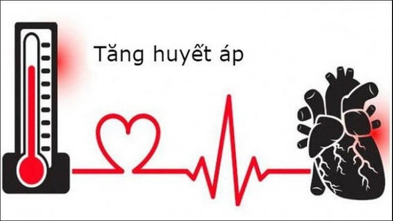 Tăng huyết áp là bệnh lý thường gặp hiện nay