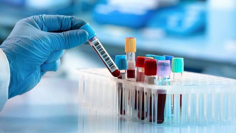 Xét nghiệm máu để kiểm tra nồng độ amoniac trong máu Xét nghiệm máu để kiểm tra nồng độ amoniac trong máu