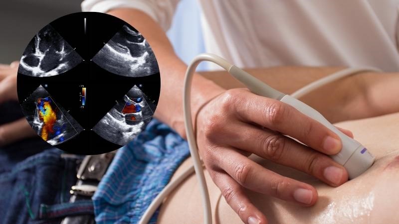 Hình ảnh siêu âm tim sẽ giúp khảo sát các bất thường ở tim
