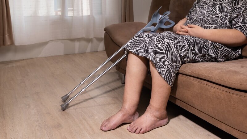 Phù nề có thể xuất hiện ở chi dưới