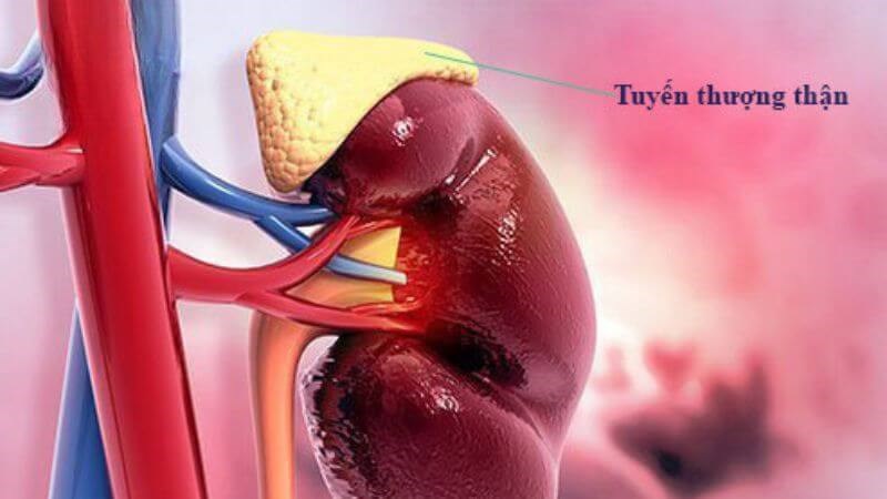 Suy tuyến thượng thận là tình trạng tuyến thượng thận bị suy giảm chức năng