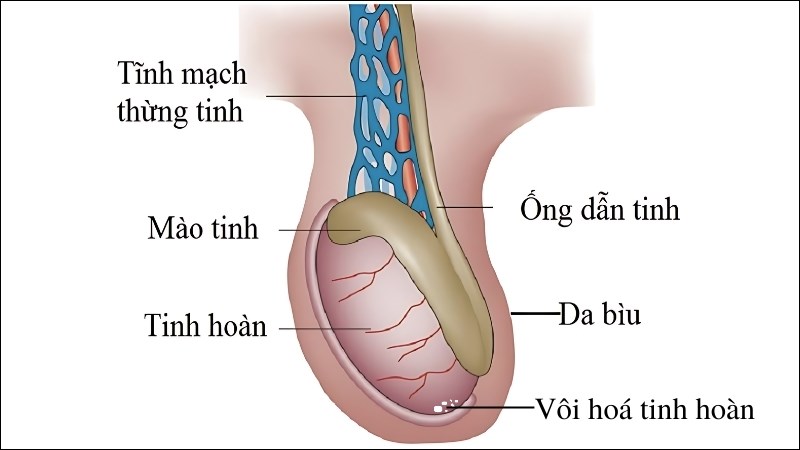 Vi vôi hóa xuất hiện ở tinh hoàn nam giới Vi vôi hóa xuất hiện ở tinh hoàn nam giới