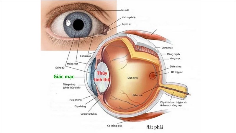 Tật viễn thị xảy ra do bất thường giác mạc còn lão thị là do thủy tinh thể kém co hồi Tật viễn thị xảy ra do bất thường giác mạc còn lão thị là do thủy tinh thể kém co hồi