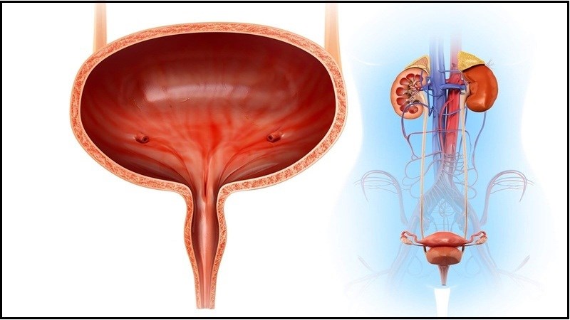 Tổn thương niêm mạc bàng quang có thể gây ra viêm bàng quang kẽ